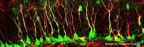 JPEG image of a section of "Forest of Memory," a Wikimedia Commons image of neurogenesis by Rebeca Cuesta. Link: https://en.m.wikipedia.org/wiki/File:%22Forest_of_memory%22.jpg