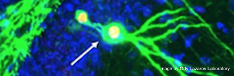 JPEG image of a section of "Engram Neurons," showing tracked memory neuron groups in neurogenesis Alzheimer's study from the Orly Lazarov Lab. Link: https://today.uic.edu/uic-scientists-discover-method-for-restoring-memory-loss-from-alzheimers-disease/