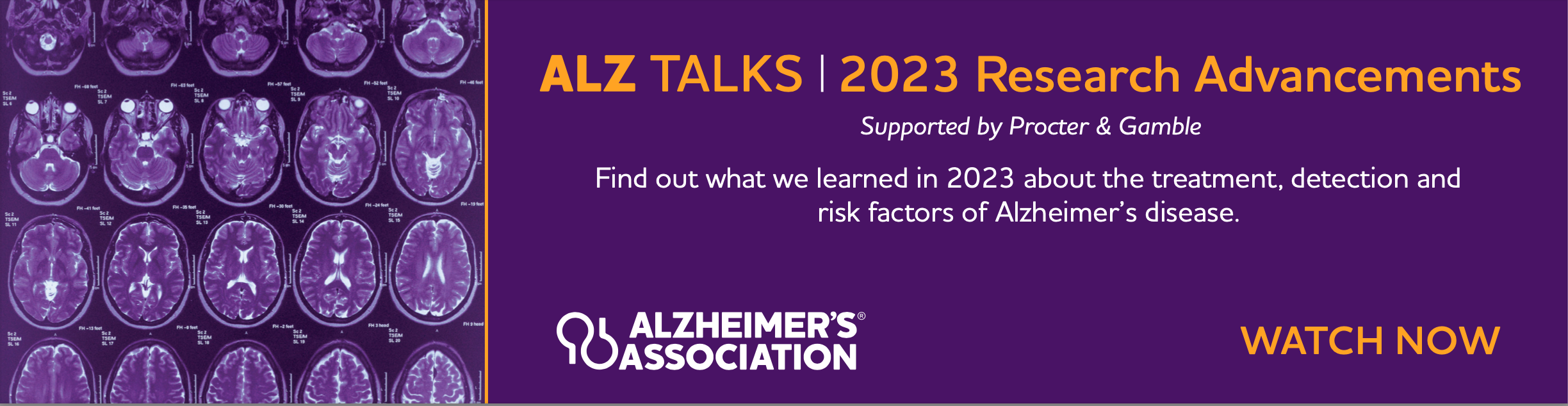 JPEG image of a 970x250 digital ad for ALZ Talks November 2023: Research Advancements.