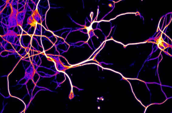Image of axons from a mouse brain model